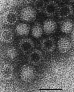 Реовирусная инфекция врановых птиц (сорок, галок, ворон), электронное фото вириона.