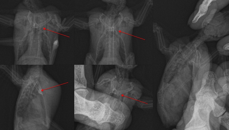 Рентген стрижа который не летает, перелом коракоида