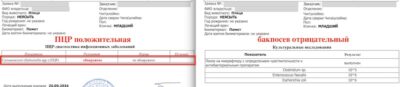 Лабораторная диагностика сальмонеллёза сов серых неясытей
